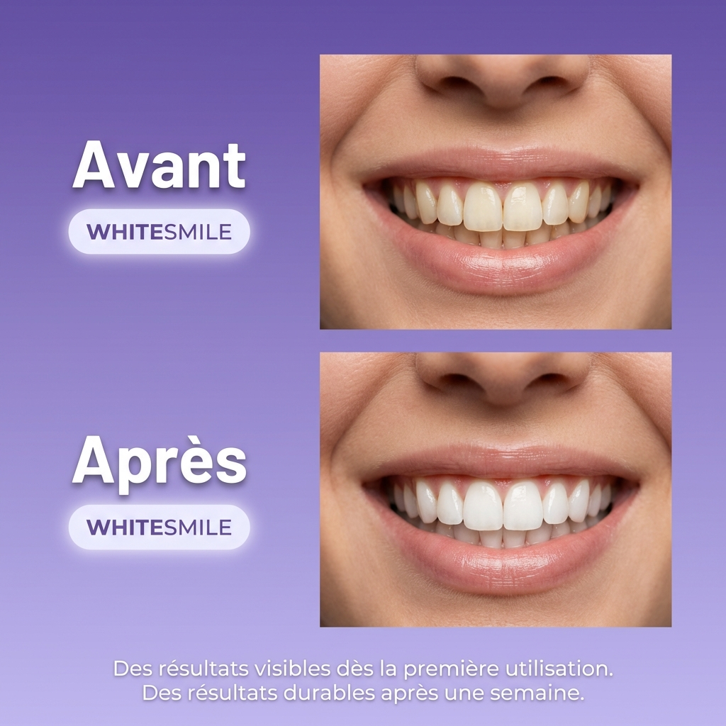 Bandes blanchissantes White Smile